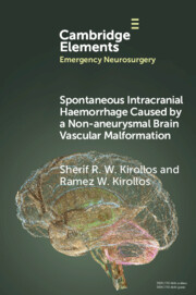 Spontaneous Intracranial Haemorrhage Caused by a Non-aneurysmal Brain Vascular Malformation