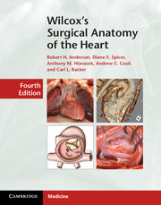 Wilcox's Surgical Anatomy of the Heart