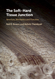 The Soft–Hard Tissue Junction