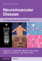 Neuromuscular Disease